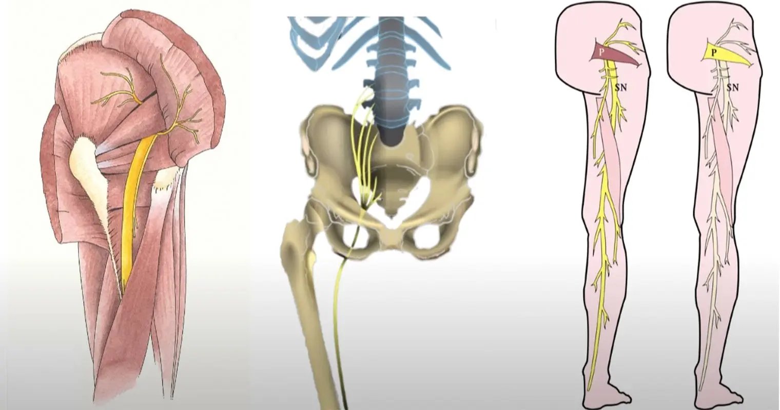 Struggling with compression stockings