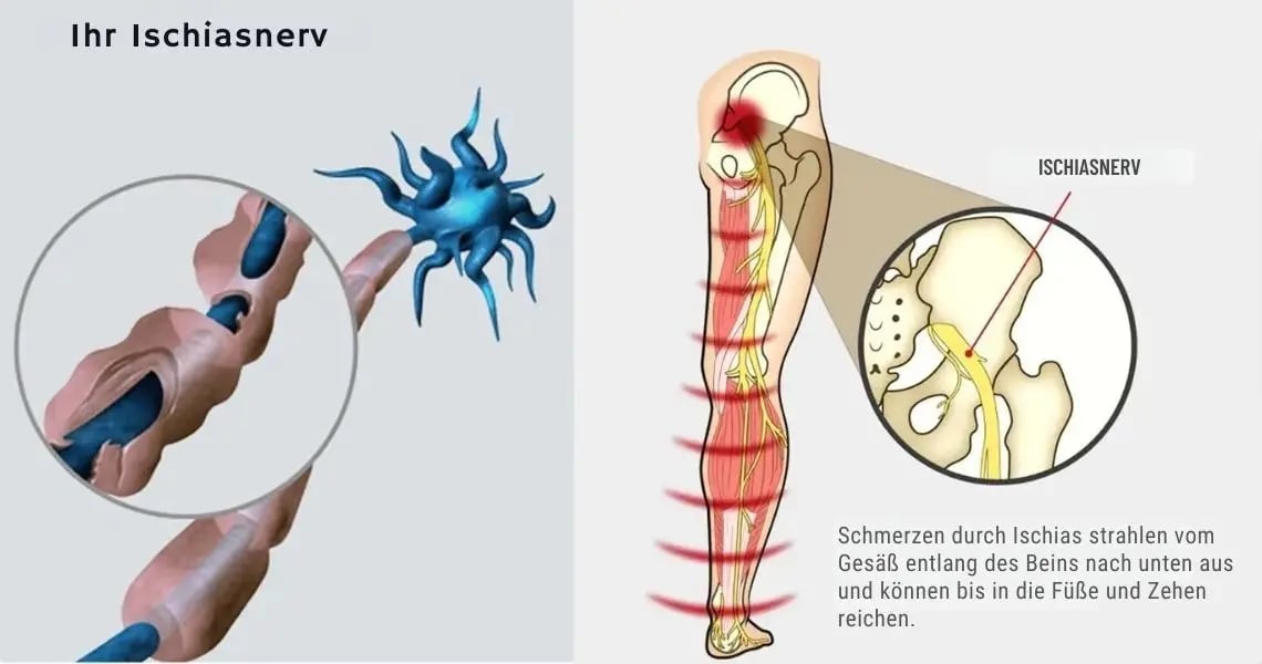 Calf muscle pump mechanism